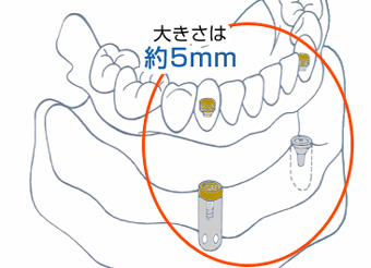 小さな装置